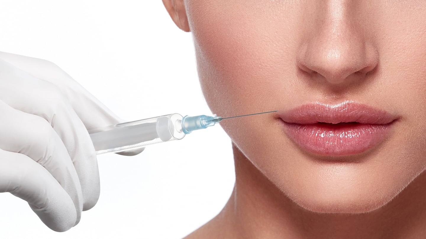 A woman receives a lip filler injection.