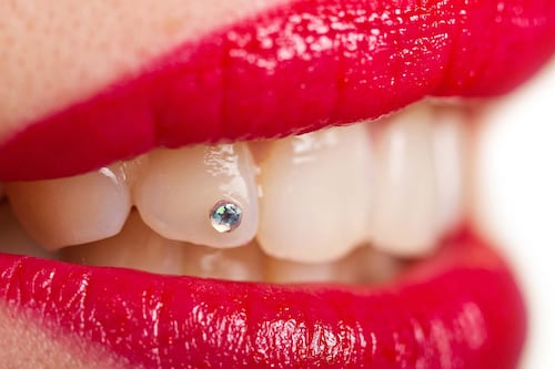 From £35 Crystals to £30,000 Diamonds: The Jaw-Dropping Rise of Tooth Jewellery